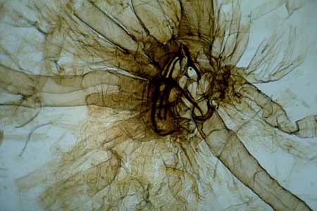 L0384_insektentracheen